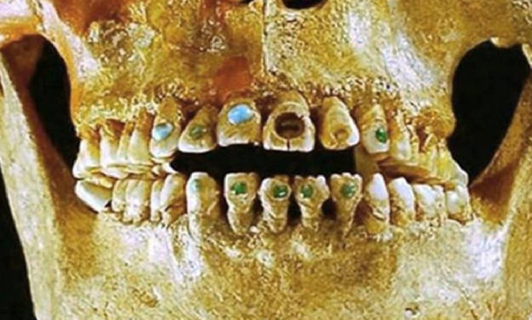 In Mexico, Archaeologists Found a 1,600-Year-Old Elongated Skull With Stone-Encrusted Teeth. - Bluefields