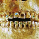 In Mexico, Archaeologists Found a 1,600-Year-Old Elongated Skull With Stone-Encrusted Teeth.